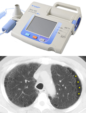 肺機能CT350