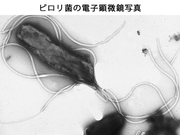 ピロリ菌の電顕写真